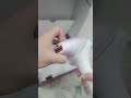 چۆنیەتی بەکارهێنانی لەیزەری فلیپس     