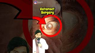 👁️ Cataract Surgery in 30 Seconds! Amazing Vision Recovery