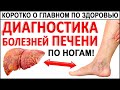 Первые Признаки больной Печени! Их видно по ногам! Если Ваша ПЕЧЕНЬ НЕЗДОРОВА, то тогда вот что.