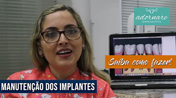 Como é feita a limpeza de implante dentários?