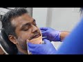 Jaw Surgery Chin Augmentation | Pack Removal | Result After 3 Days