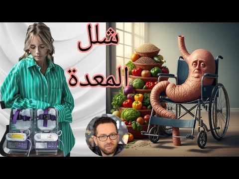 فتاة لم تأكل لقمة طعام طيلة حياتها أيما كوك أشهر مغنية في هولندا المصابة بشلل المعدة