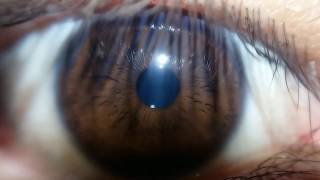 Macro Video Of My Eye