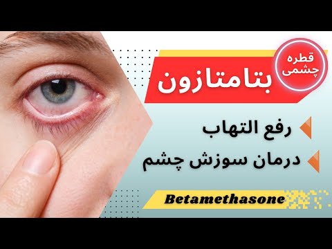 قطره چشمی بتامتازون پرمصرف ترین دارو برای کاهش سوزش و التهاب چشم