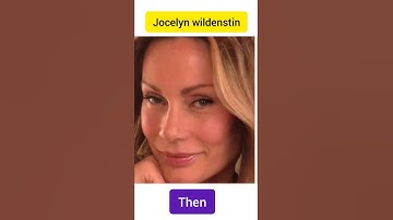 extreme plastic surgery fails⚠ #shorts #plasticsurgery (jocelyn wildenstin) part(2)