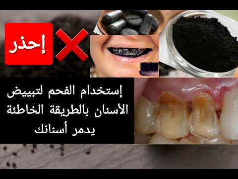 إحذر تبييض الأسنان بالفحم بالطريقة الخاطئة يدمر أسنانك إليك الطريقة الصحيحة لتبييض الأسنان بالفحم