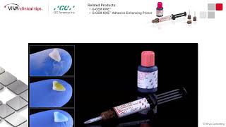 Dr. Cone on G-CEM ONE and G-CEM ONE Adhesive Enhancing Primer Dr. Cone on G-CEM ONE and G-CEM ONE Adhesive Enhancing Primer