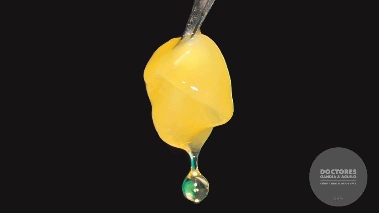 Platelet Rich Plasma regeneration. Regeneración dental con plasma