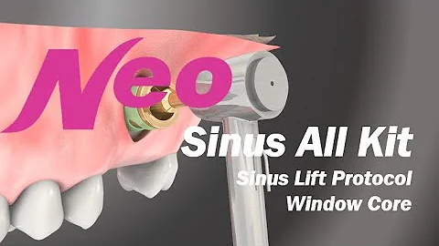 Sinus Lift: Sinus All Kit (Window Core)