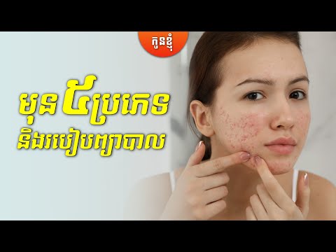 មុន៥ប្រភេទ និងរបៀបព្យាបាល | 5 types of acne and how to treat