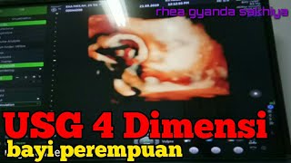 Usg 4 Dimensi Usia Kandungan 7 Bulan Bayi Perempuam Dan Bandingkan Foto Hasil Lahiran Apa Sama Youtube