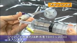 カームソリッドの説明・導入方法