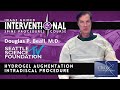 Hydrogel Augmentation Intradiscal Procedure - Douglas P. Beall, M.D.