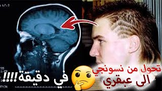 المرض الوحيد في العالم الذي ستتمنى أن يصيبك ???