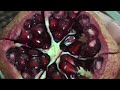افضل طريقه لتقشير الرمان The best way to peel pomegranate