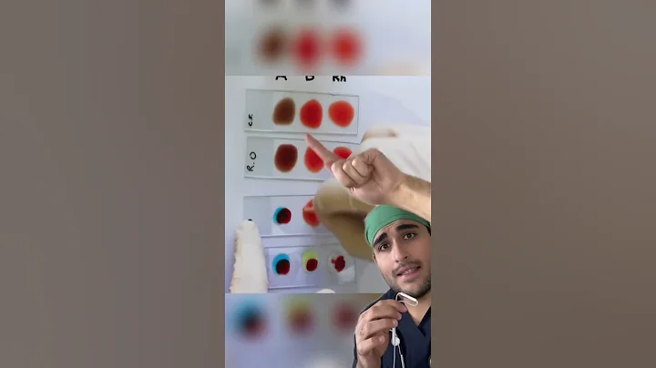 Doctor explains: How to know your blood type?!🤯🤯
