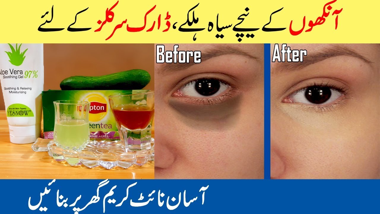 Remove Under Eyes Dark Circles Homemade Night Cream Home Remedies Urdu Remove Under Eyes Dark Circles Homemade Night Cream Home Remedies Urdu