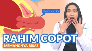 Rahim Copot, Emang Bisa?
