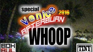 Venice Beach Afterburn Whoop