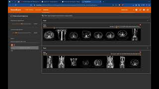 MedGAN: Leveraging GANs for Realistic Medical Imaging Generation to Enhance Diagnostic Training Data