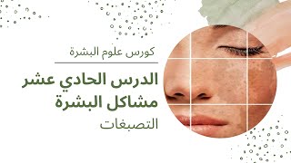 كورس علوم البشرة | تصبغات الجلد | النمش الكلف بقع نقص الفيتامين بقع الشمس | الحلول و العلاج