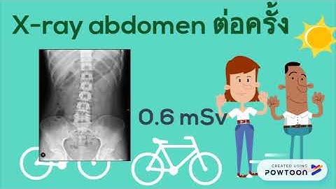 Radiation in daily life group 8