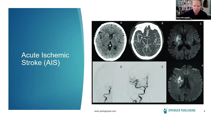 Updates in Stroke Care 2023