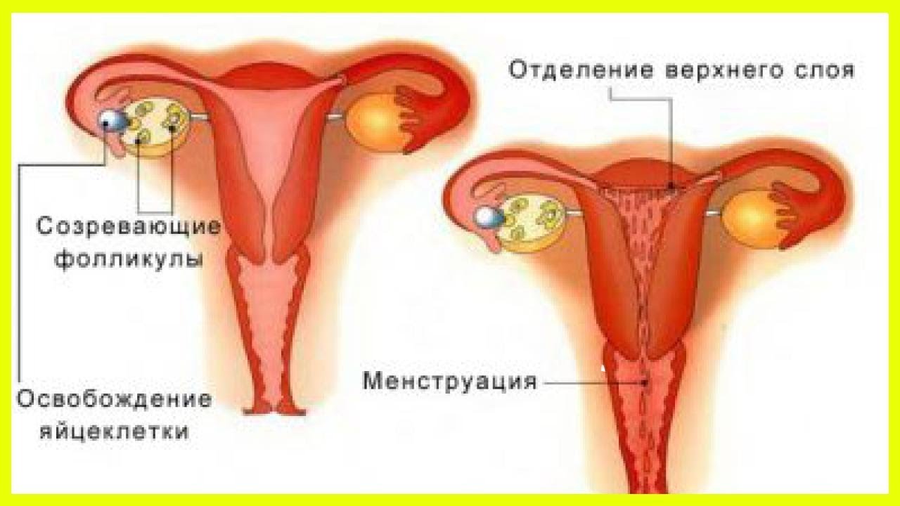 Почему из влагалища идет кровь (не менструация)?