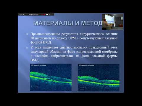 «Интравитреальное введение ингибиторов