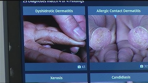 App Created Locally Helps Doctors Diagnose Patients