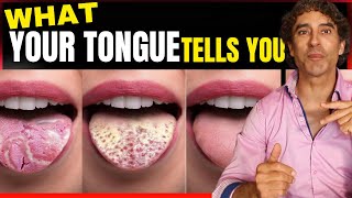 What Your Tongue Reveals About Your Health !!