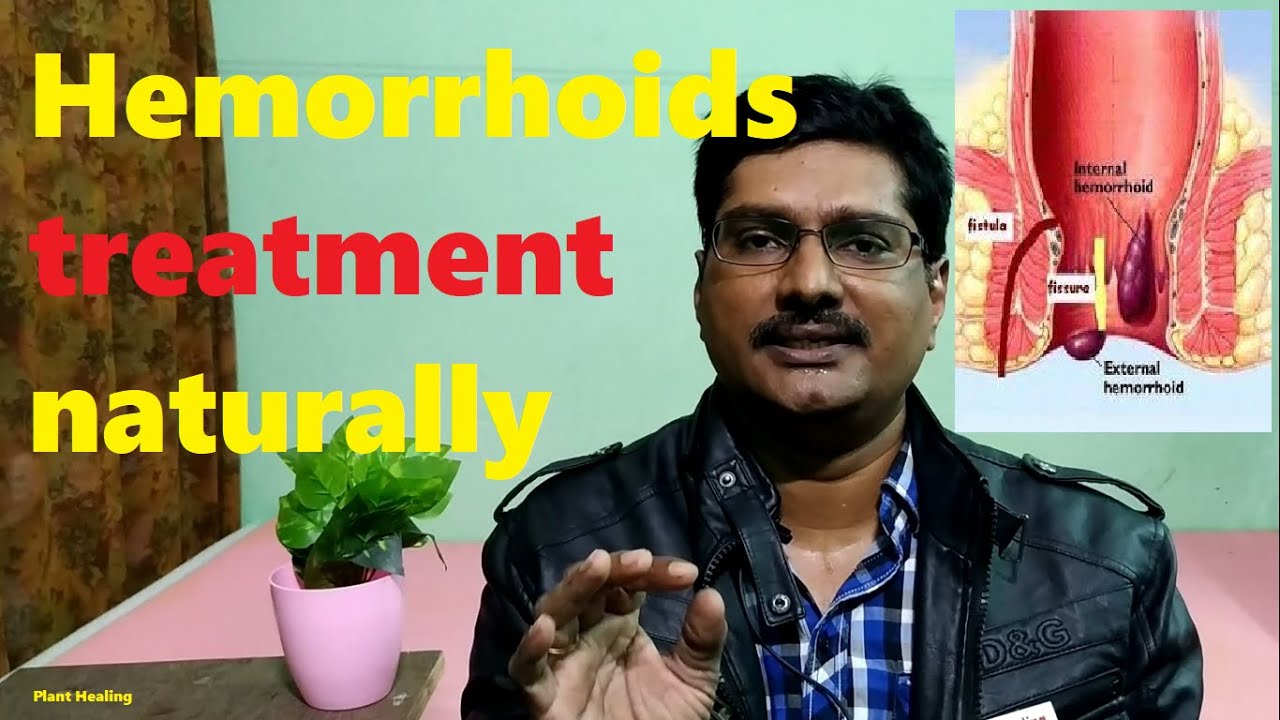 hemorrhoids, piles, fissures, fistula causes and natural healing