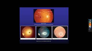 Details 9-25-2026- Lysosomal Storage Disorders 2 (Wilcox) Guide