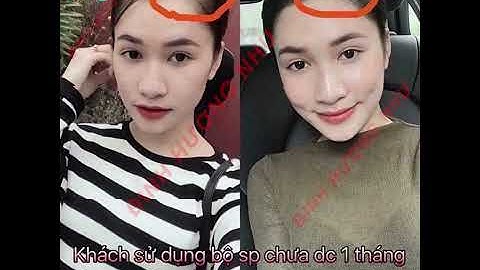 Chia sẽ bí quyết cách ngăn rụng tóc và làm dày tóc Đinh Hương Nhu