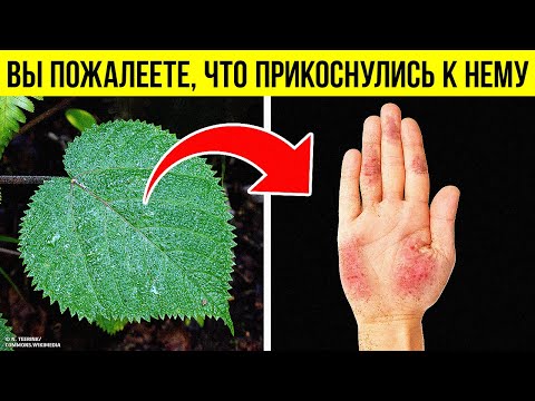 Коварное растение, ожог которого не заживает годами