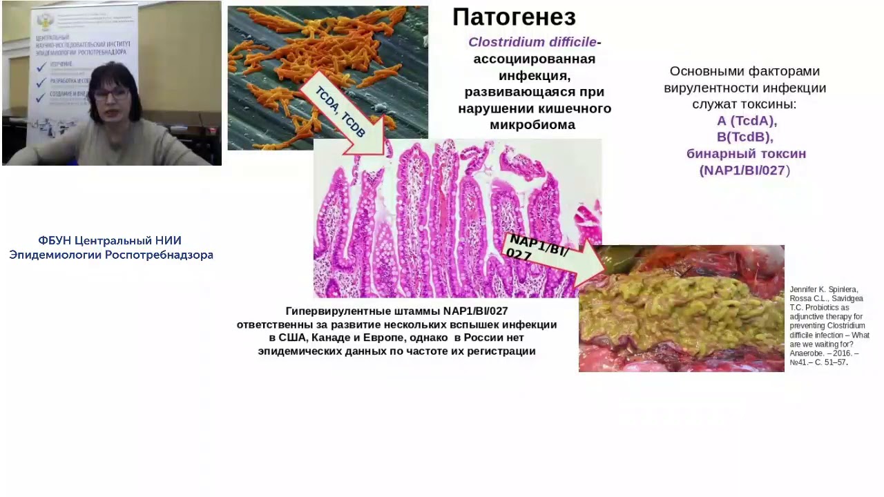 Современные аспекты атибиотикоасоциированного колита у взрослых - YouTube