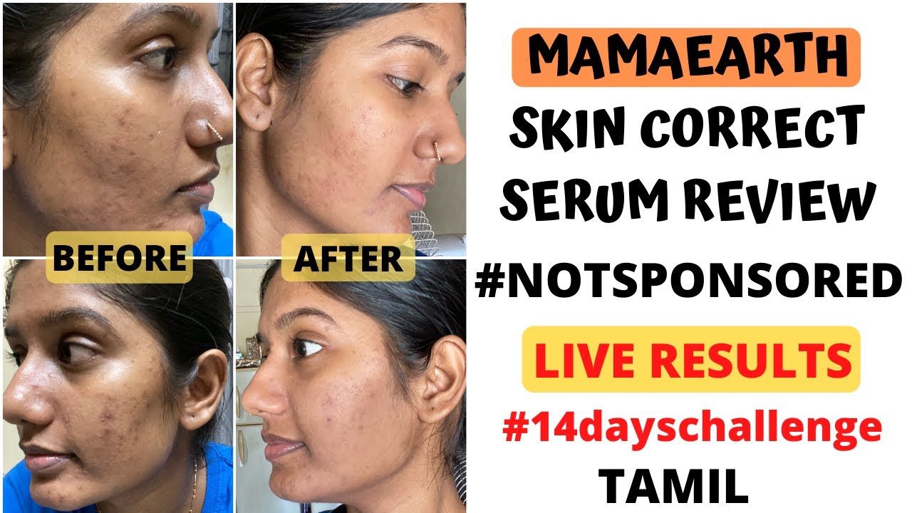 mamaearth face correct serum
