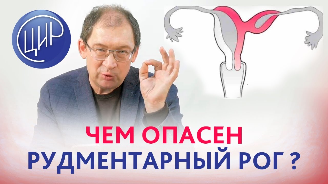 Рудиментарный рог матки. Чем опасен добавочный рудиментарный рог матки?