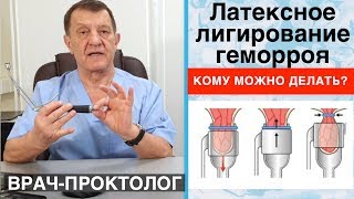 видео: ЛАТЕКСНОЕ ЛИГИРОВАНИЕ ГЕМОРРОЯ - Кому можно делать? картинка: ЛАТЕКСНОЕ ЛИГИРОВАНИЕ ГЕМОРРОЯ - Кому можно делать?