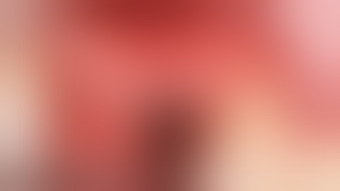 Split crest com piezocirurgia