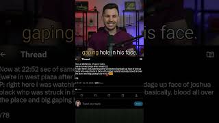 Celebrity Big Gaping Hole #shorts Profile