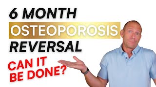 How to Reverse Osteoporosis in 6 Months!