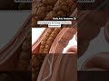 Illustration of constipation in cross-sectional movement | Gut Health | Body Arts Anatomy 3D