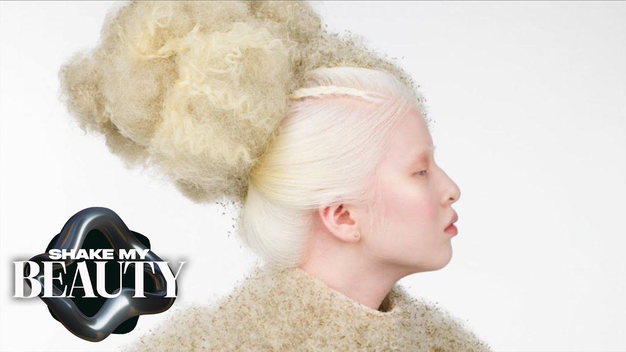 Disowned Because Albinism Brings 'Bad Luck' | SHAKE MY BEAUTY