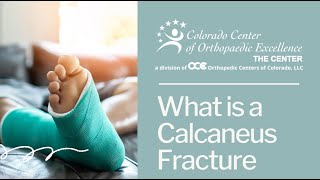 Calcaneus Fracture - What is it, how can it happen, how is it treated and who should I go see.