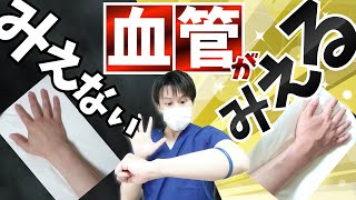 【ルート確保】見えない血管を見えるようにする方法！浮腫対策もあり！【看護師】