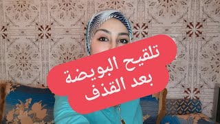 متى يتم تلقيح البويضة بعد القذف (سرعة الحيوانات المنوية- مسافة الوصول للبويضة)