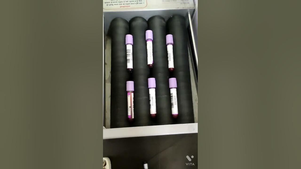 cbc-test-cbc-test-kya-hota-hai-cbc-test-kese-kiya-jata-hai-cbc