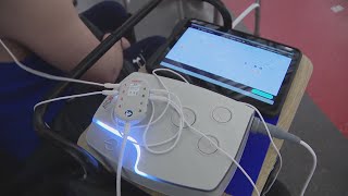 Non-invasive stimulation device shows promise in treating spinal cord injuries