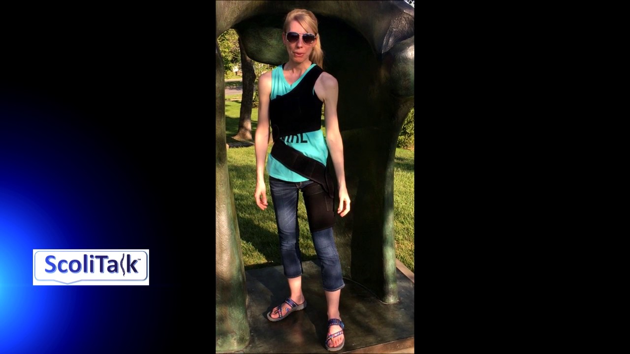 ScoliTalk: Project SAS 10  (Episode 2)